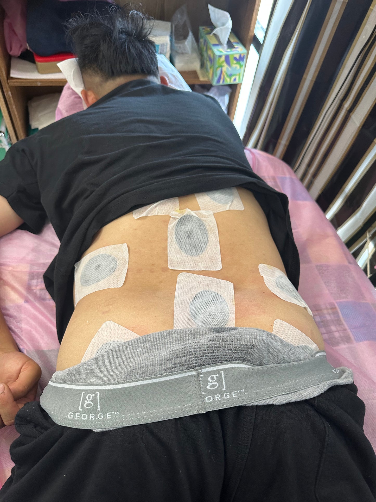 1. Upper body treatment (上半身)