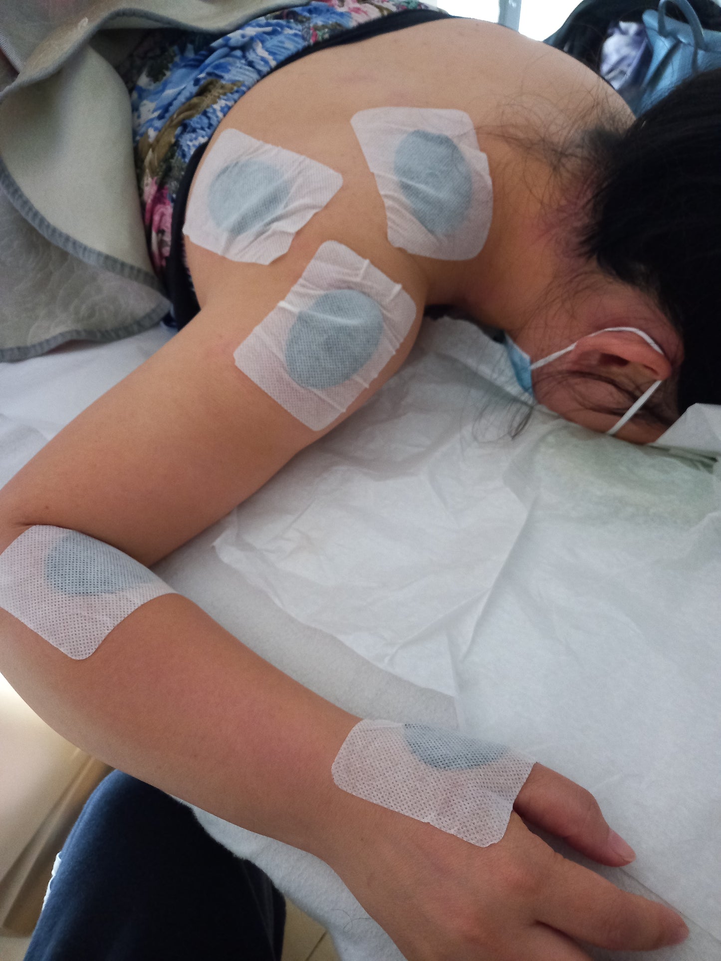 1. Upper body treatment (上半身)