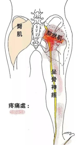 2. Lower body treatment (下半身)