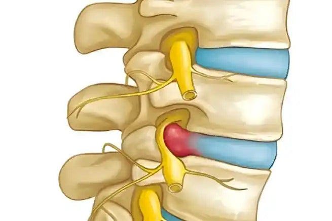 1. Upper body treatment （上半身）